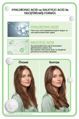 Morfose Metamorfose Arındırıcı Bakım Şampuanı 400 ML